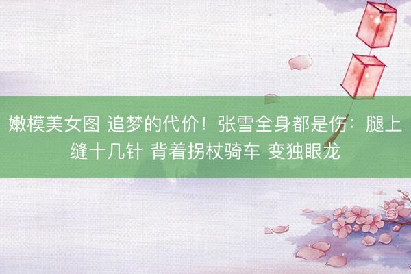 嫩模美女图 追梦的代价!张雪全身都是伤:腿上缝十几针 背着拐杖骑车 变独眼龙